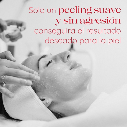 Consecuencias inmediatas de un PEELING QUÍMICO PROFUNDO Consecuencias inmediatas de un PEELING QUÍMICO PROFUNDO